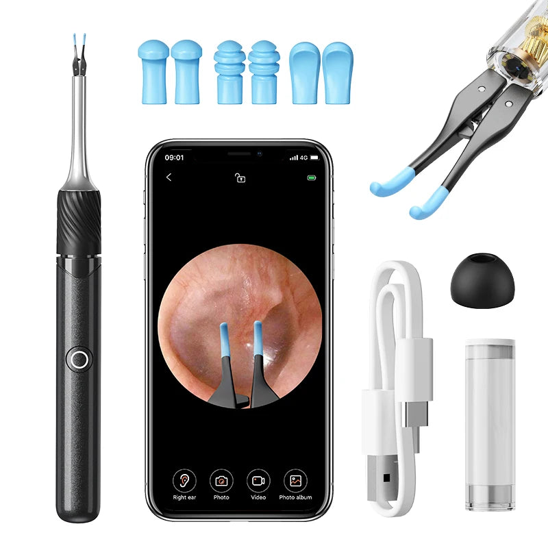 SUNUO Ear Wax Removal Visual Otoscope Kit With Tweezers