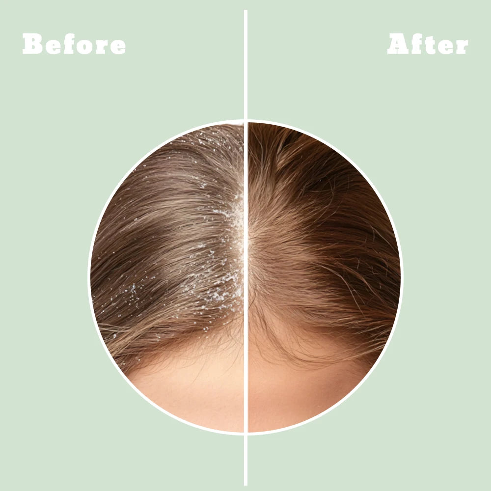ALFHEIM Rosemary Purifying Haircare Set Shampoo Conditioner