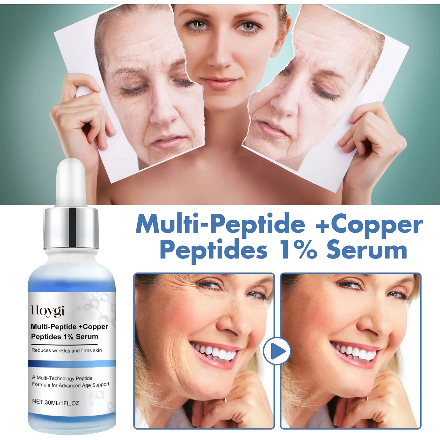 Hoygi Copper Peptide Serum For Anti Wrinkle And Skin Rejuvenation