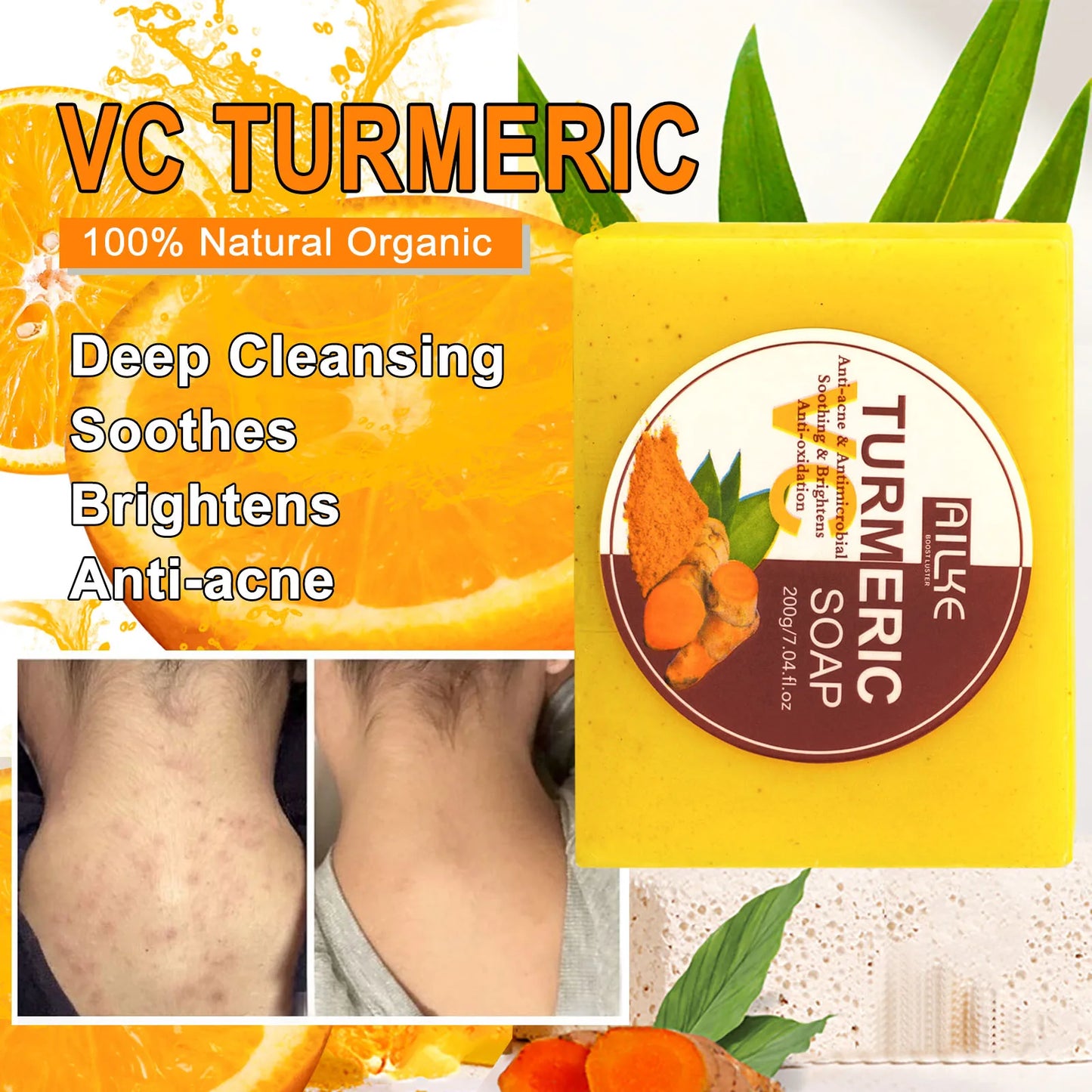 AILKE Organic Turmeric Skin Care Set Brightening Acne Treatment