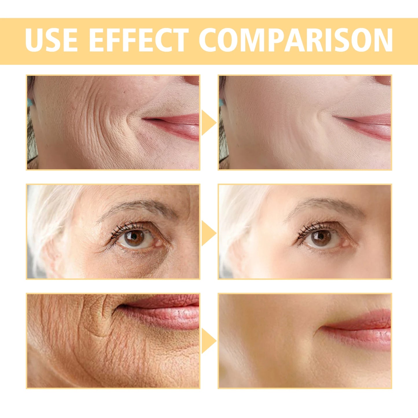 Hoygi Retinol Cream With Hyaluronic Acid For Forehead Lines And Pores Tightening