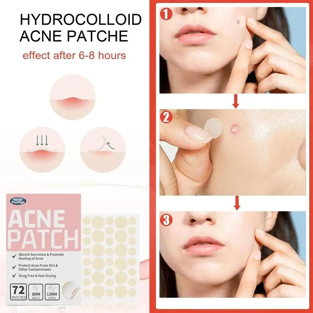 Eelhoe 72Pcs Invisible Salicylic Acid Acne Patches Waterproof Anti Acne Spot Treatment