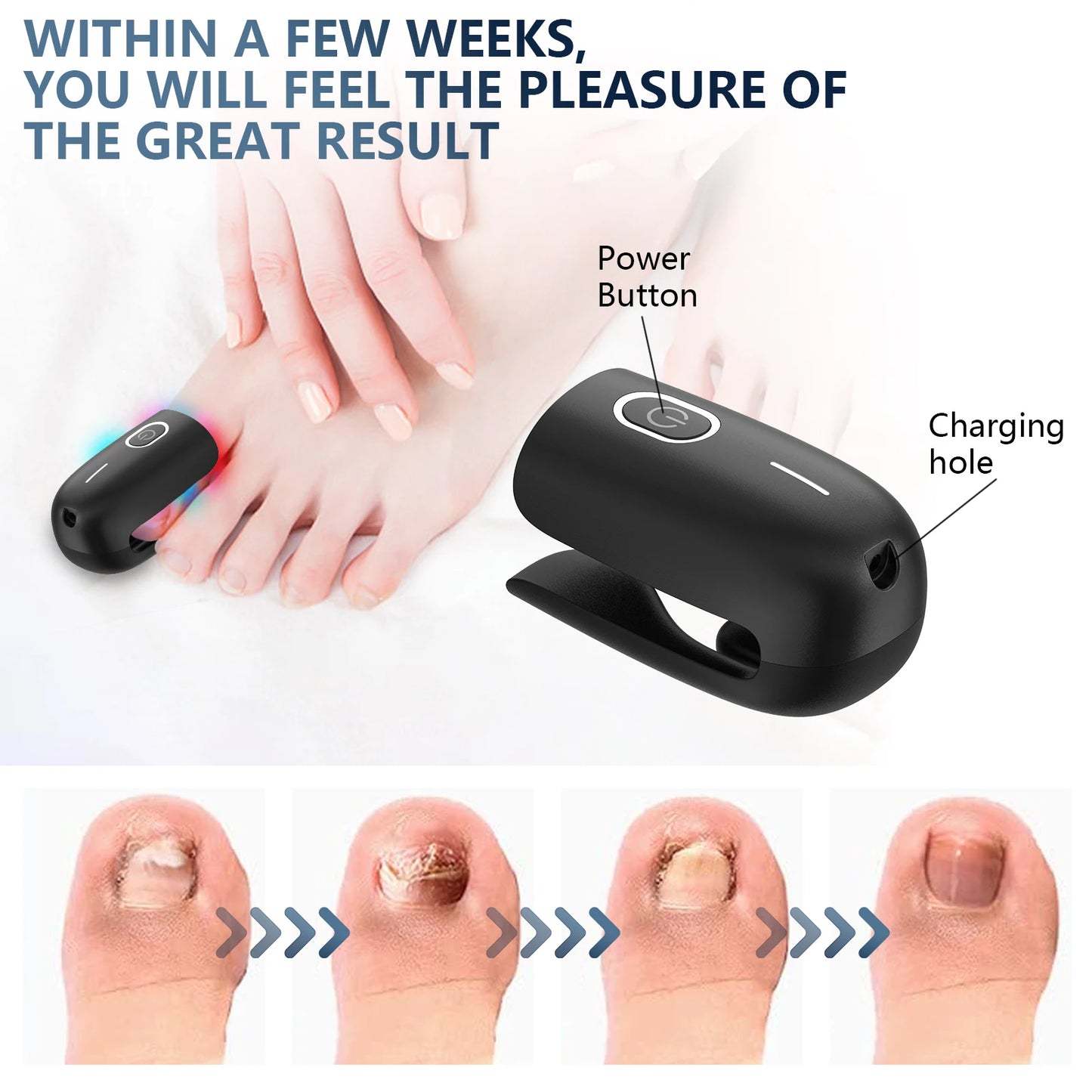 Toenail Fungus Treatment Device With 470nm And 905nm Infrared Light