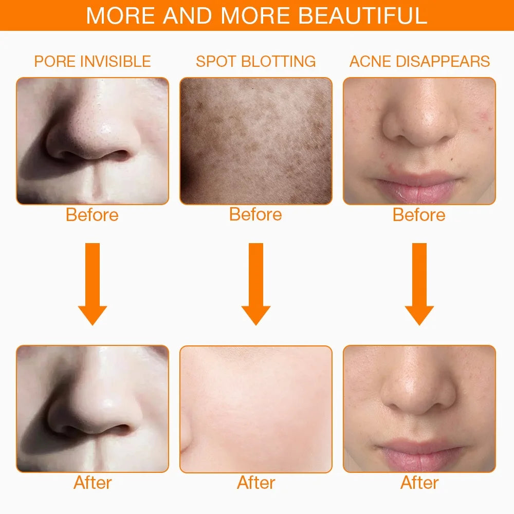 Foreverlily LED Facial Mask For Skin Rejuvenation Treatment