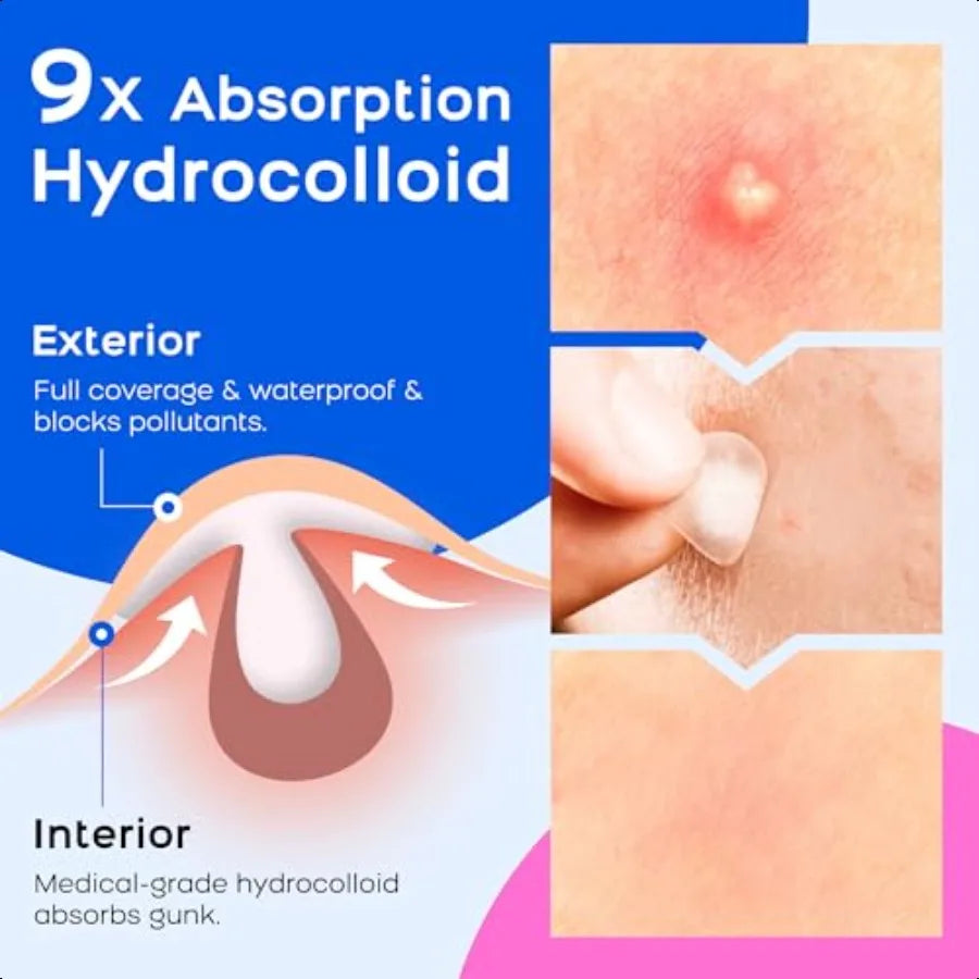 Hydrocolloid Pimple Patches For Face Invisible Acne Zits Blemish Coverage