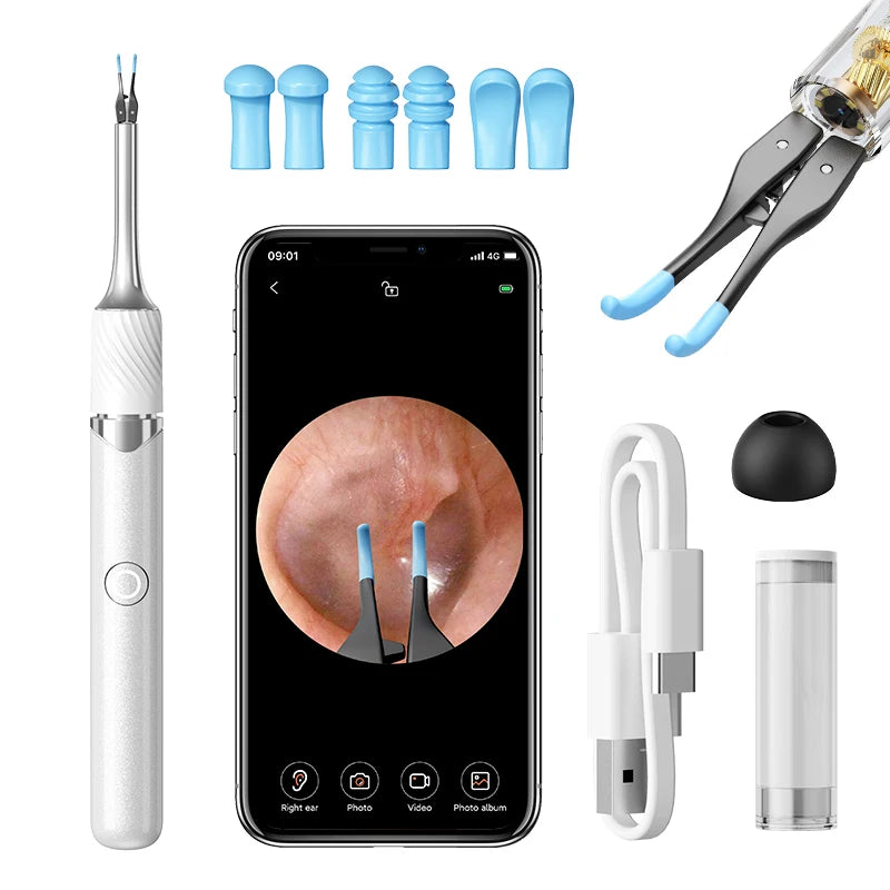 SUNUO Ear Wax Removal Visual Otoscope Kit With Tweezers