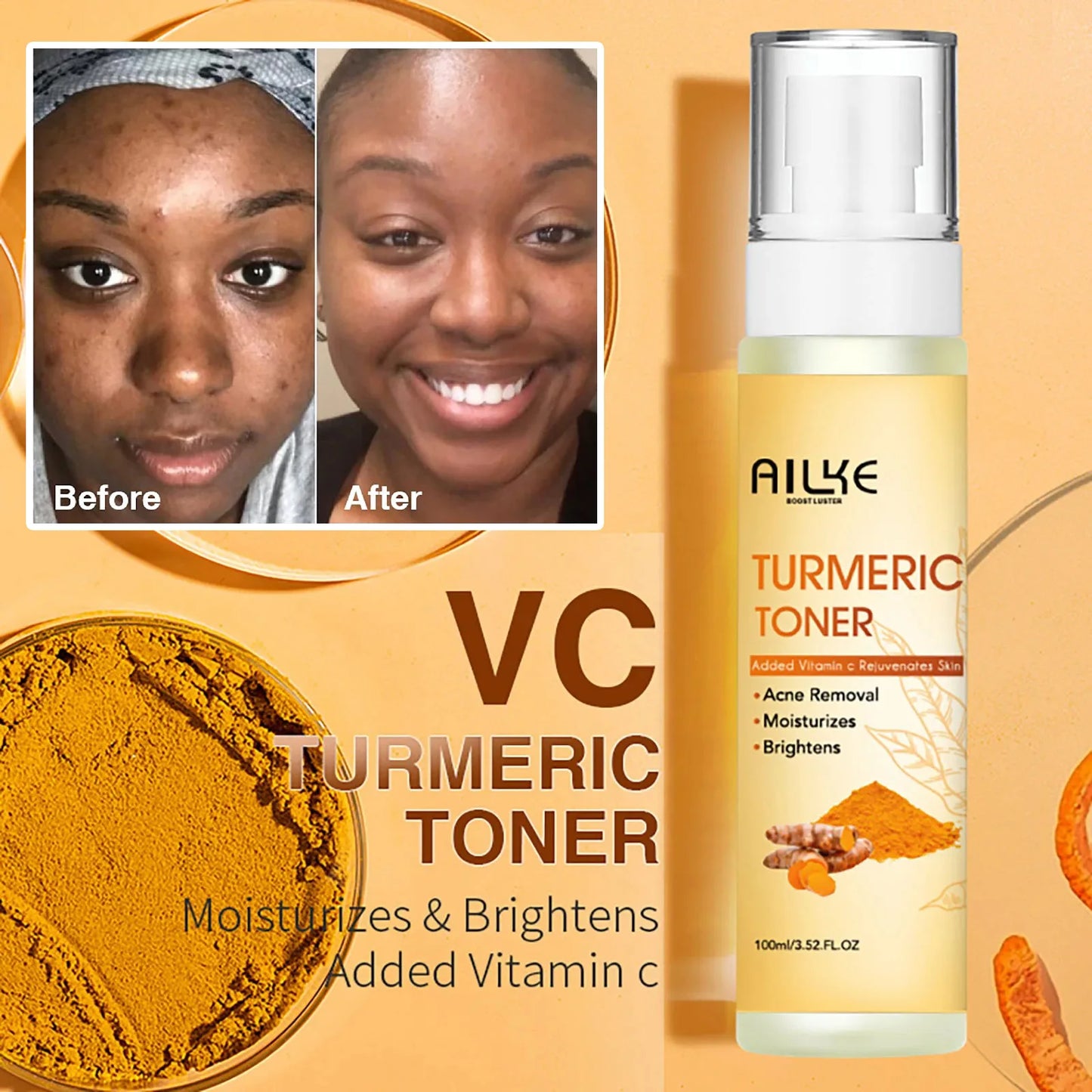 AILKE Organic Turmeric Skin Care Set Brightening Acne Treatment
