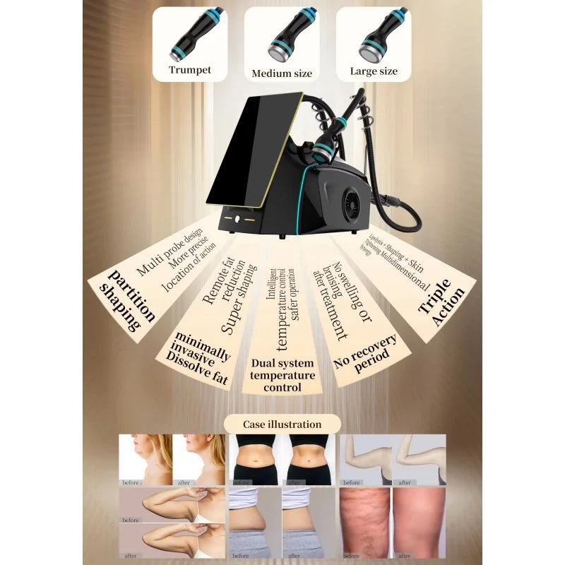 Onda Ice Microwave Skin Tightening Machine For Body Contouring