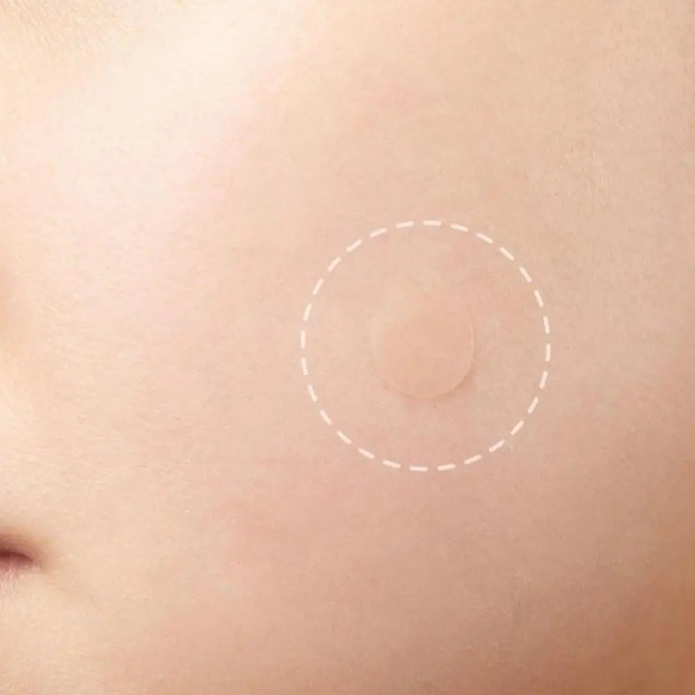 Eelhoe 72Pcs Invisible Salicylic Acid Acne Patches Waterproof Anti Acne Spot Treatment