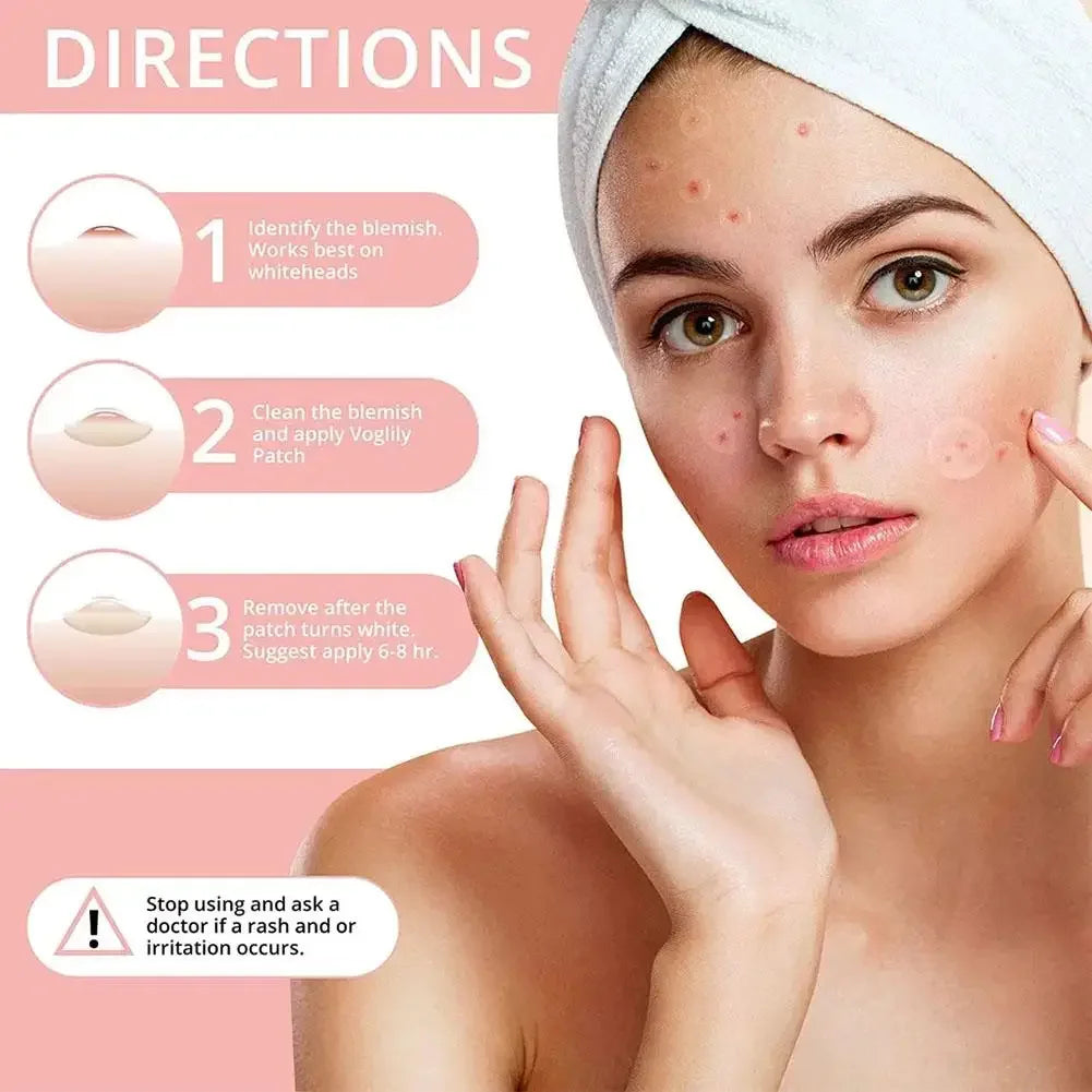 Eelhoe 72Pcs Invisible Salicylic Acid Acne Patches Waterproof Anti Acne Spot Treatment